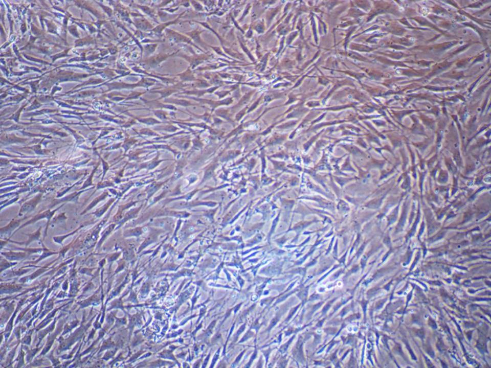 Primary - Human Mesenchymal Stem cells - Viability 78 per cent